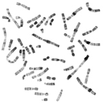 cytogenetika / karyotypizacia